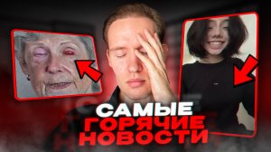 Подрезание Уголков Рта Новый Тренд😳Женщине Пересадили Зуб В Глаз..Самые Горячие Новости