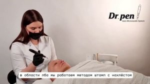 Микронидлинг в домашних условиях
