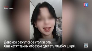 Погоня за "красотой": подростки режут себе уголки губ, чтобы сделать улыбку шире