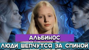 Жизнь с альбинизмом: быть не как все