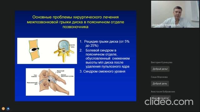 Лечение межпозвоночной (межпозвонковой) грыжи. Рассказывает нейрохирург Дуров Олег Владимирович