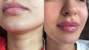 ScreenRecording_09-15-2025 20-43-13_1