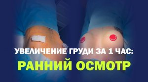Увеличение груди 300 мл: идеальная форма от Сунгатуллина
