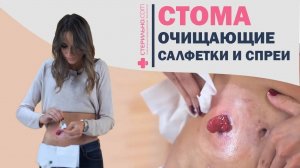 Как правильно очистить кожу вокруг стомы? | Стерильно.com 4К