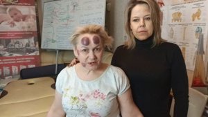 После процедуры Косметическая Хиджама сразу стало легче. (Отзыв) Хаджам-мастер Олег-Олаф Гудвин.