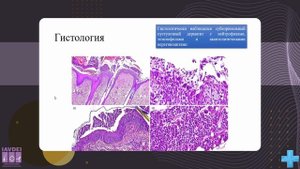 ЧТО НОВОГО? Предполагаемая пузырчатоподобная реакция на пероральный прием флураланера у собаки