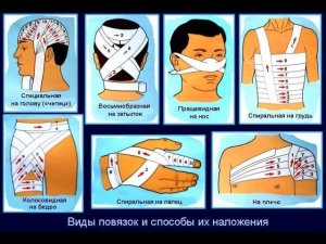 ДЕСМУРГИЯ. Повязки