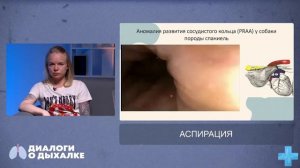 Аспирация