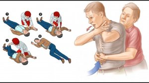 Устойчивое боковое положение и приемы Геймлиха