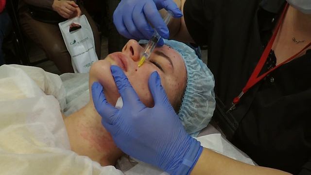 Практический мастер-класс по мезотерапии смотреть онлайн