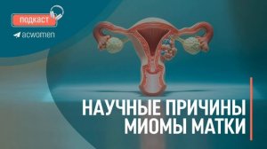 🎧Подкаст «Научные причины миомы матки»