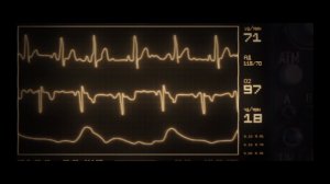 Мир т DLS Ваффентрагер