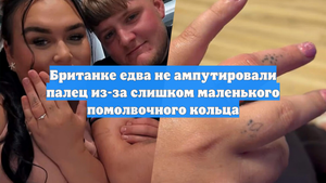 Британке едва не ампутировали палец из-за слишком маленького помолвочного кольца