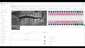 🦷 Future IT Dent + Dentomo: автоматическая диагностика и план лечения