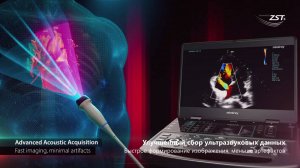 Новый аппарат ультразвуковой диагностики МЕ7Ехр - простота в использовании