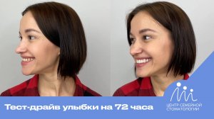 Тест-драйв новой улыбки за 72 часа | Примерка виниров в Центре Семейной Стоматологии