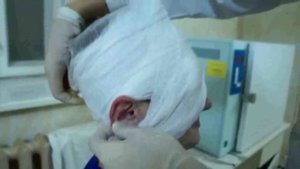 ДЕСМУРГИЯ. Повязки