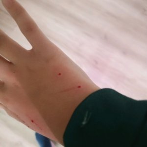 укради Брейн рот