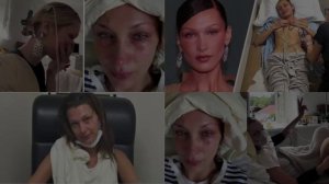 Белла Хадид тяжело больна? Что случилось
