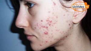 Husnbuzarlardan bir umrga qutilishni istaysizmi - Yuz parvarishi !!!