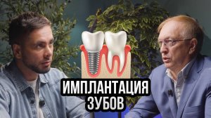 Имплантация зубов. Отвечает на вопросы доктор стоматолог-имплантолог Осипов Андрей Викторович
