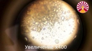 Грибок, вызвавший порчу авокадо