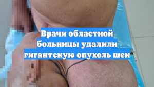 Врачи областной больницы удалили гигантскую опухоль шеи