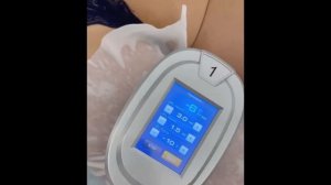 Процедура криолиполиз с применением салфеток SLIM