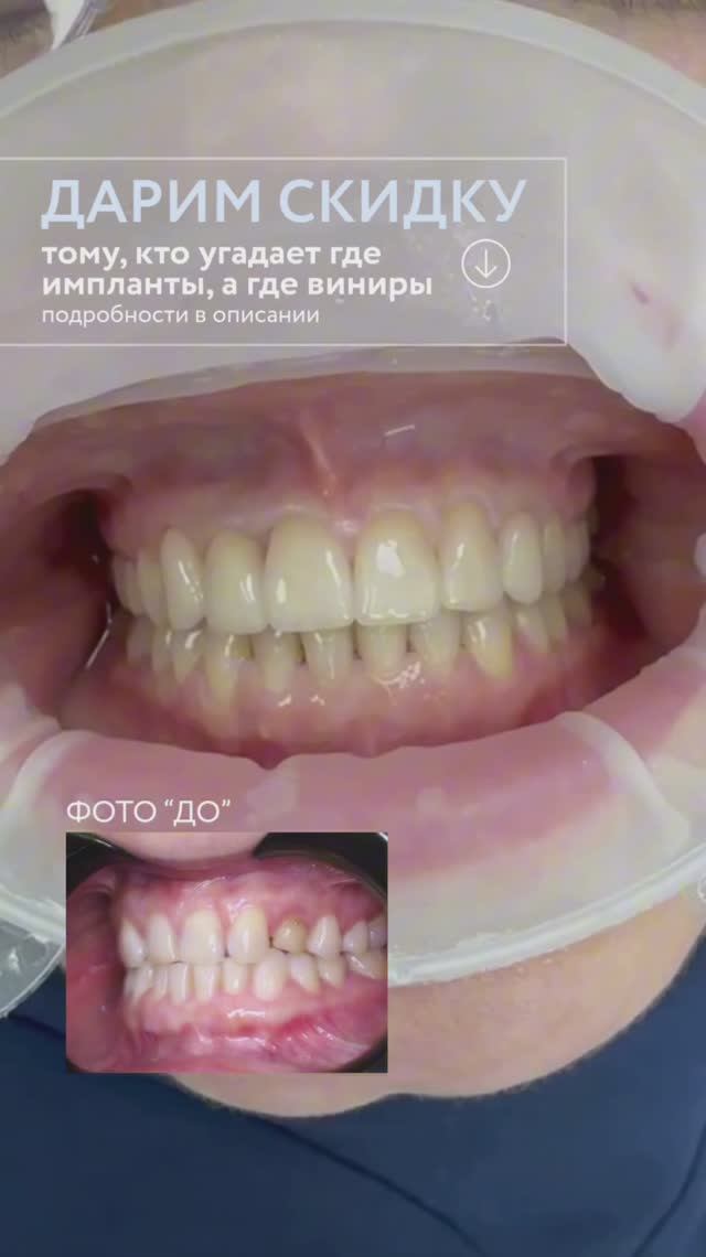 Отгадайте и получите скидку!