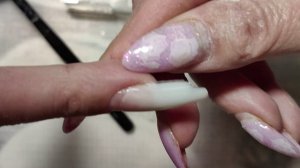 САМА СЕБЕ! ОНИХОЛИЗИС! ХРОНИКА ИЗ 5 РАБОТ!