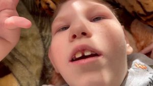 Кома сразу после рождения или история