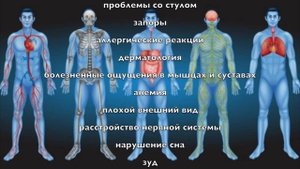 Паразиты и где они обитают?