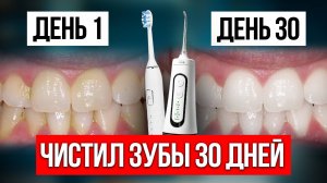 Я 30 дней чистил зубы электрической щеткой и ирригатором — ЧЕСТНЫЙ РЕЗУЛЬТАТ