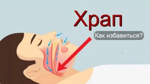 Храп во сне. Как избавиться?