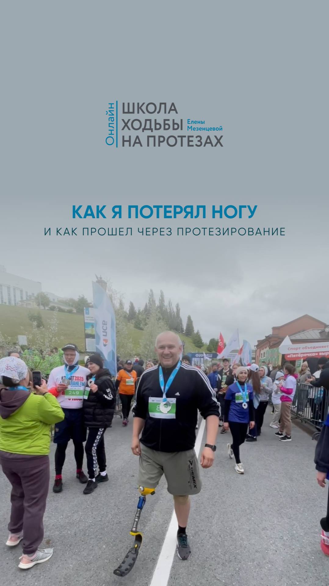 Как я потерял ногу и прошел через протезирование