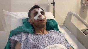 Пострадавший в ДТП в Турции: водитель автобуса слишком быстро ехал