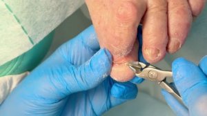 Немного живого общения и процедур