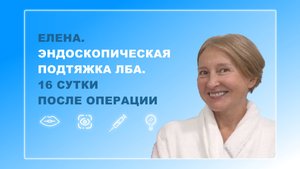 Елена. Подтяжка лба. 16 сутки после операции
