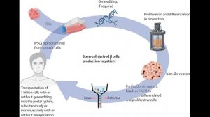 Будущее терапии диабета 1 типа. The Lancet Journal 19.09.2025