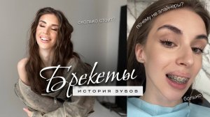 Ношу брекеты 5 месяцев 🦷 | Капа от бруксизма и для ВНЧС | Почему не элайнеры?