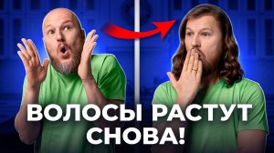 Как включить рост волос? Облысение больше не страшно