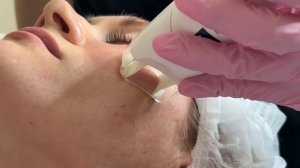 LPG лица в клиниках "Абрикосик"