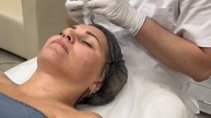 4.2 УЗ чистка