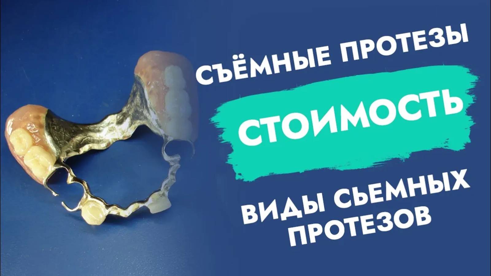 Краткий гид по видам и ценам на съемные зубные протезы.