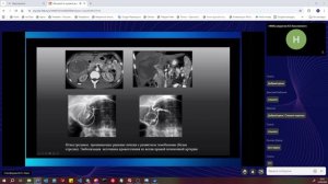 5 25092025 Рентгенология боевых ранений