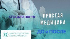 СПА для ногтя