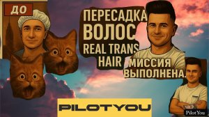 Пересадка волос без пересадок ✈️ | Мой опыт Real Trans Hair