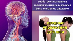 Зона риска в шее: холка. Как освободить нервы шейно-грудного перехода?