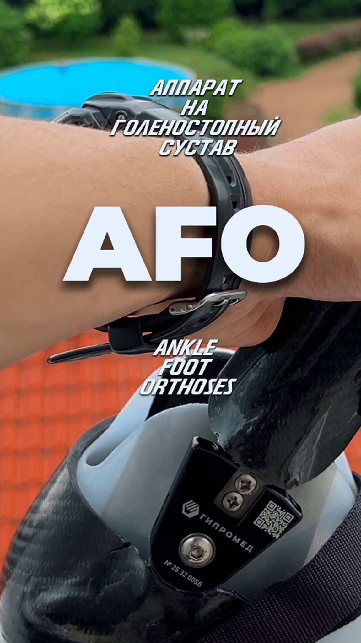 Ортез при деформациях ноги