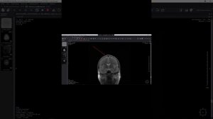 МРТ проекции